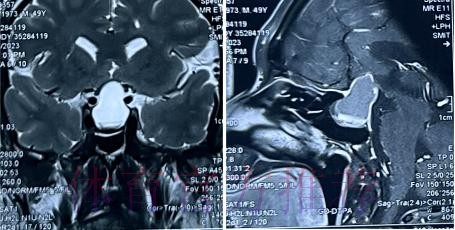 经核磁共振检查确认 塞巴略斯伤情没有预期严重 经核磁共振检查确认 塞巴略斯伤情没有预期严重